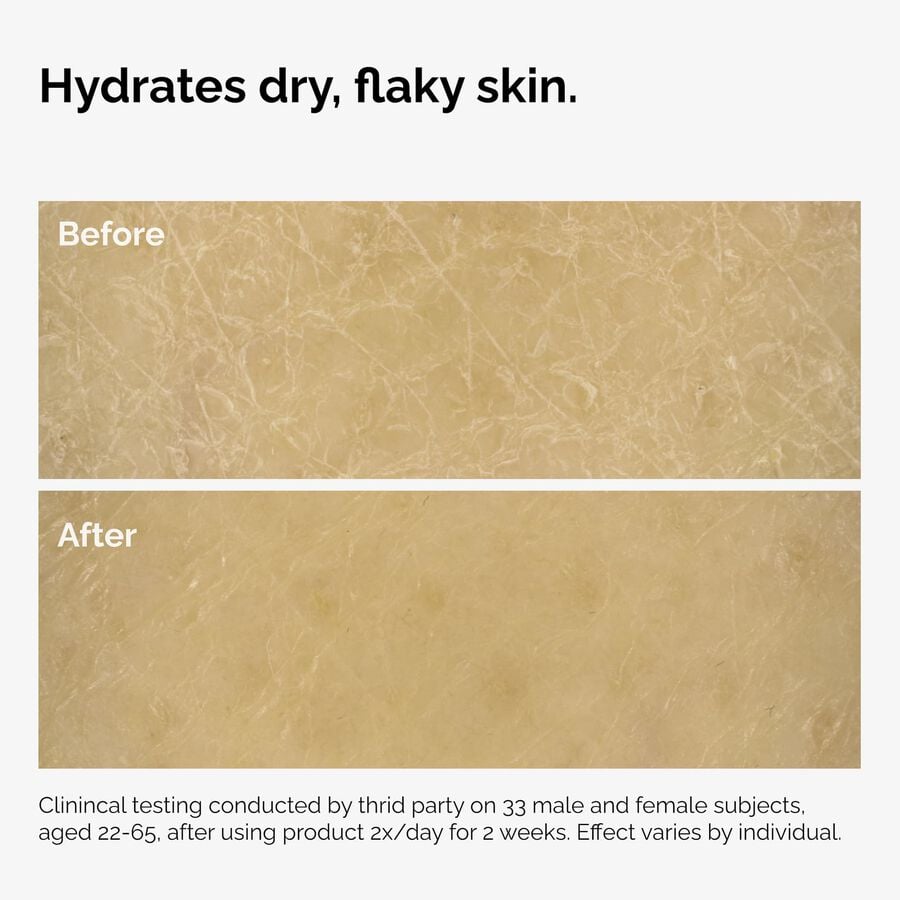 the-body-care-collection-m3 ord-natural-moisturizing-factors-inulin-body-before-after-graphic-02.jpg