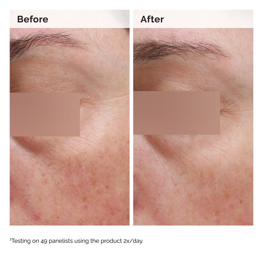 niacinamide-5-face-and-body-emulsion-q2 2024-08-23-ORD-Nia-5pct-Face-Body-B-A-Elasticity-Global-02-1x1.jpg