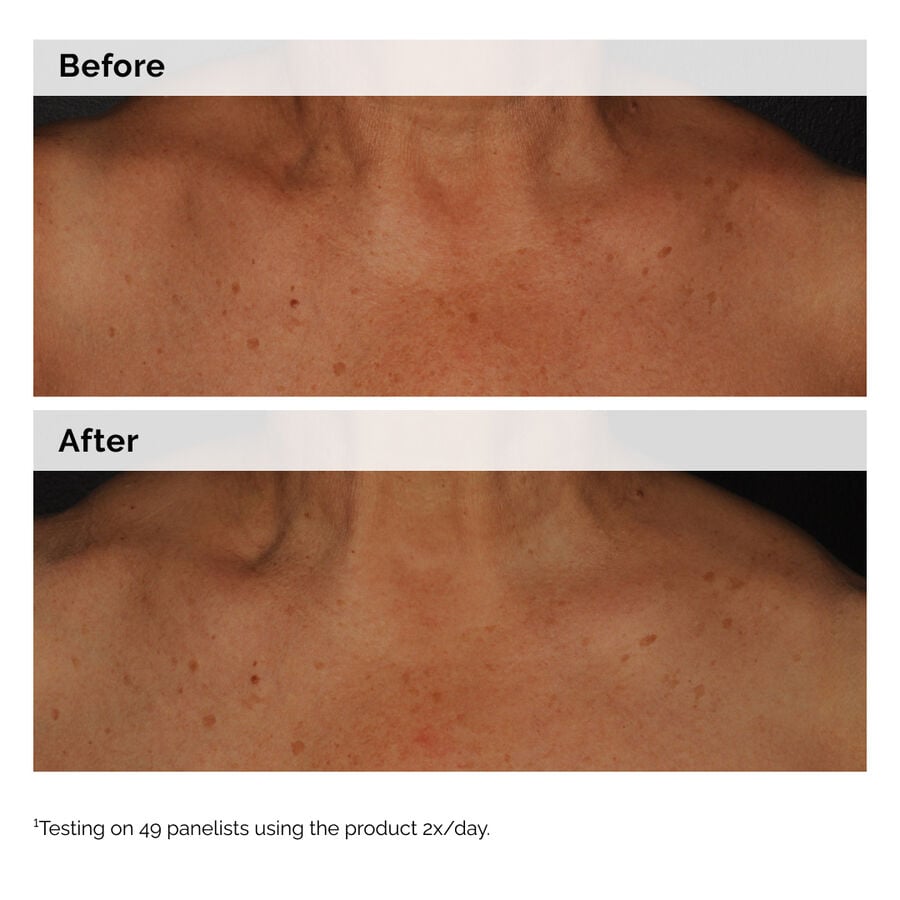 niacinamide-5-face-and-body-emulsion-q2 2024-08-23-ORD-Nia-5pct-Face-Body-B-A-Global-02-1x1.jpg