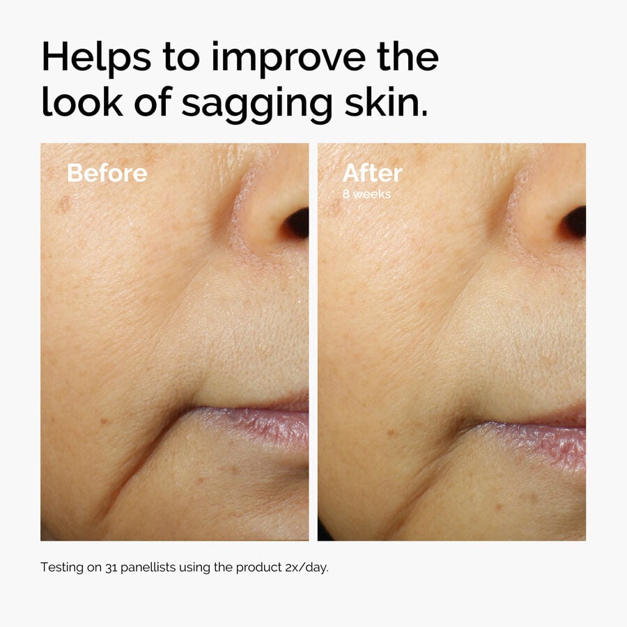 caffeine-3-escin-1-face-serum-b2 ord-caffeine-3pct-escin-1pct-face-serum-before-after-sagging.jpg