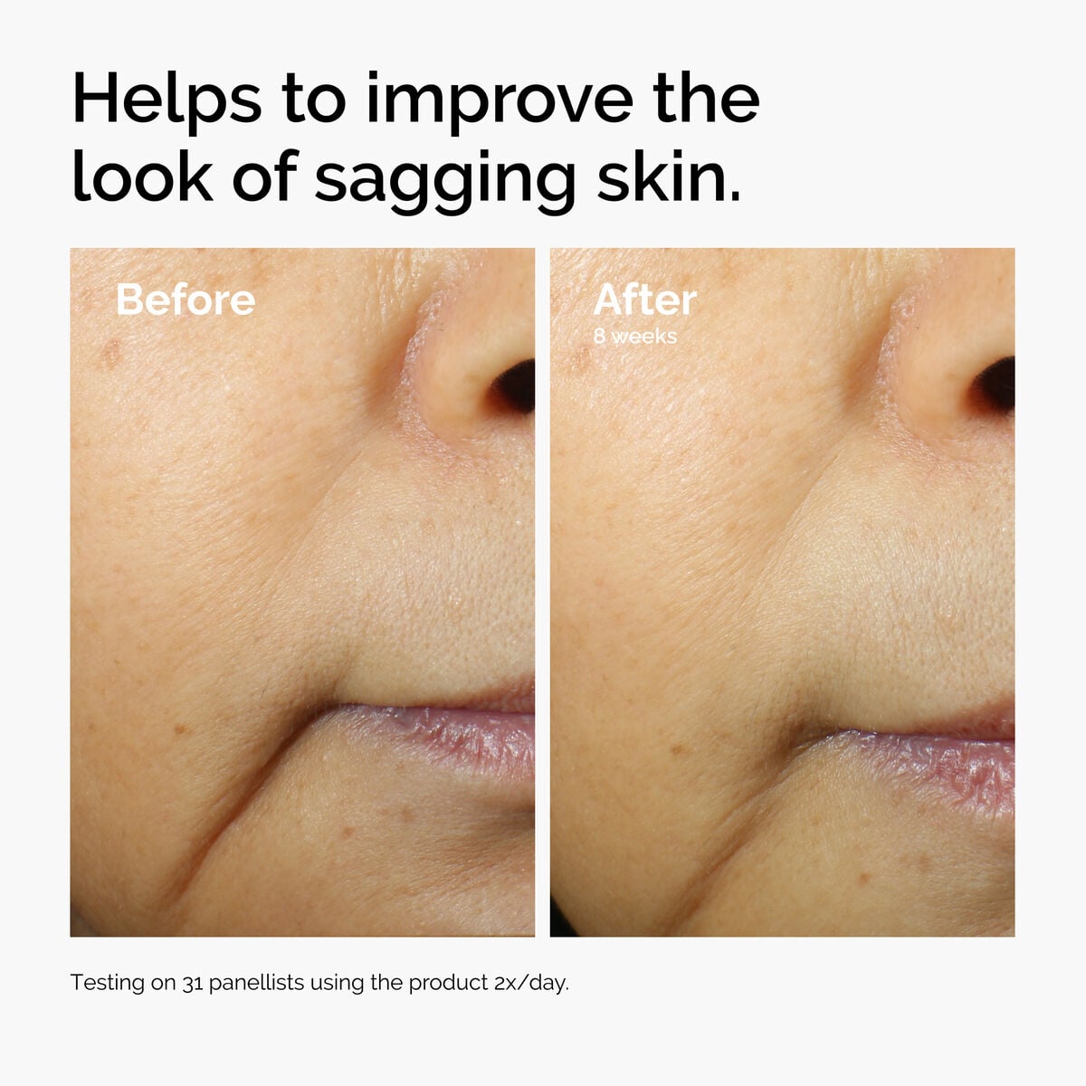 caffeine-3-escin-1-face-serum-b2 ord-caffeine-3pct-escin-1pct-face-serum-before-after-sagging.jpg