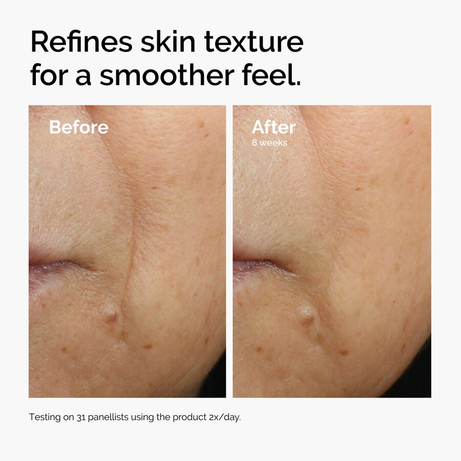 caffeine-3-escin-1-face-serum-b2 ord-caffeine-3pct-escin-1pct-face-serum-before-after-texture.jpg