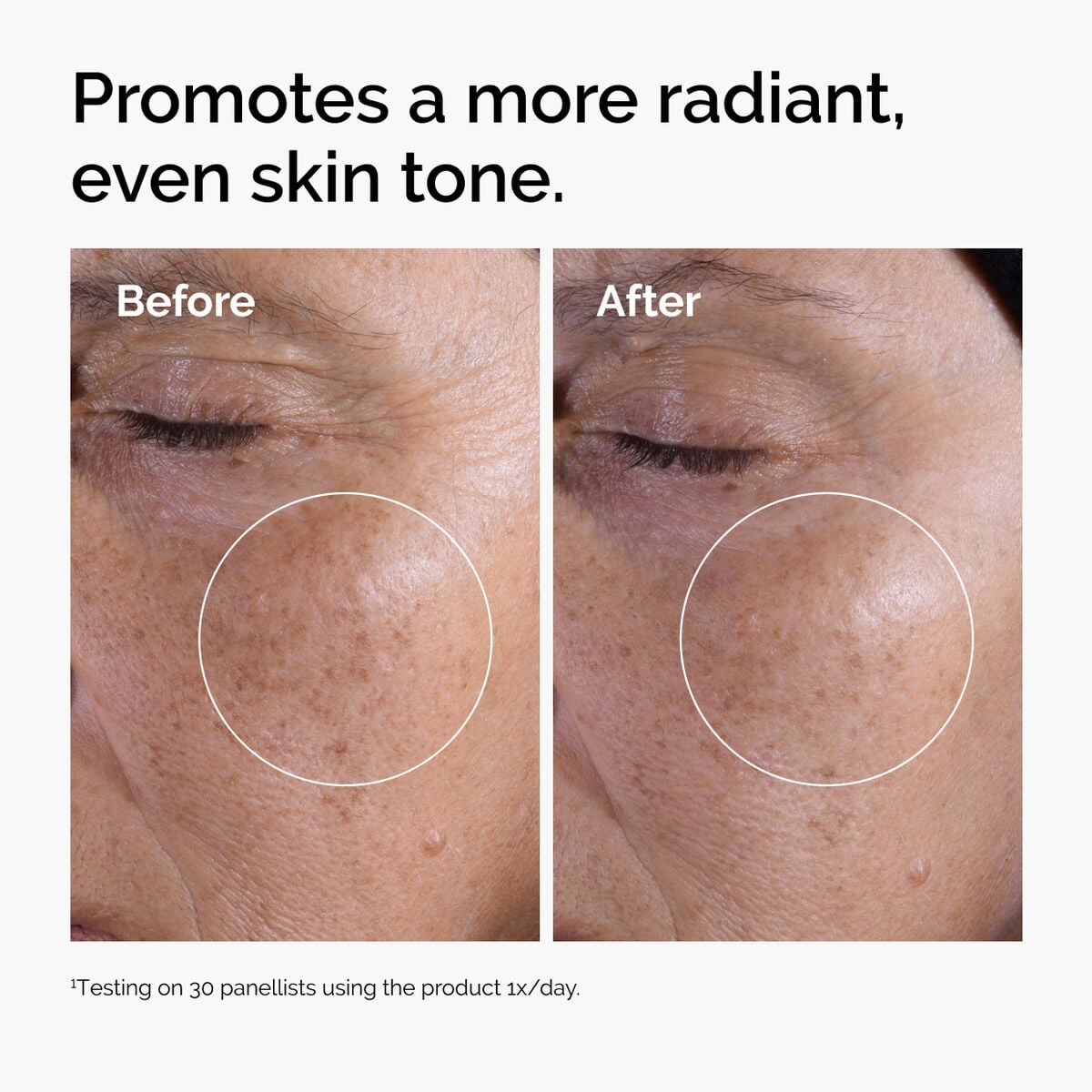 glycolic-acid-7-exfoliating-toner-r8 ord-glycolic-before-after-radiance.jpg
