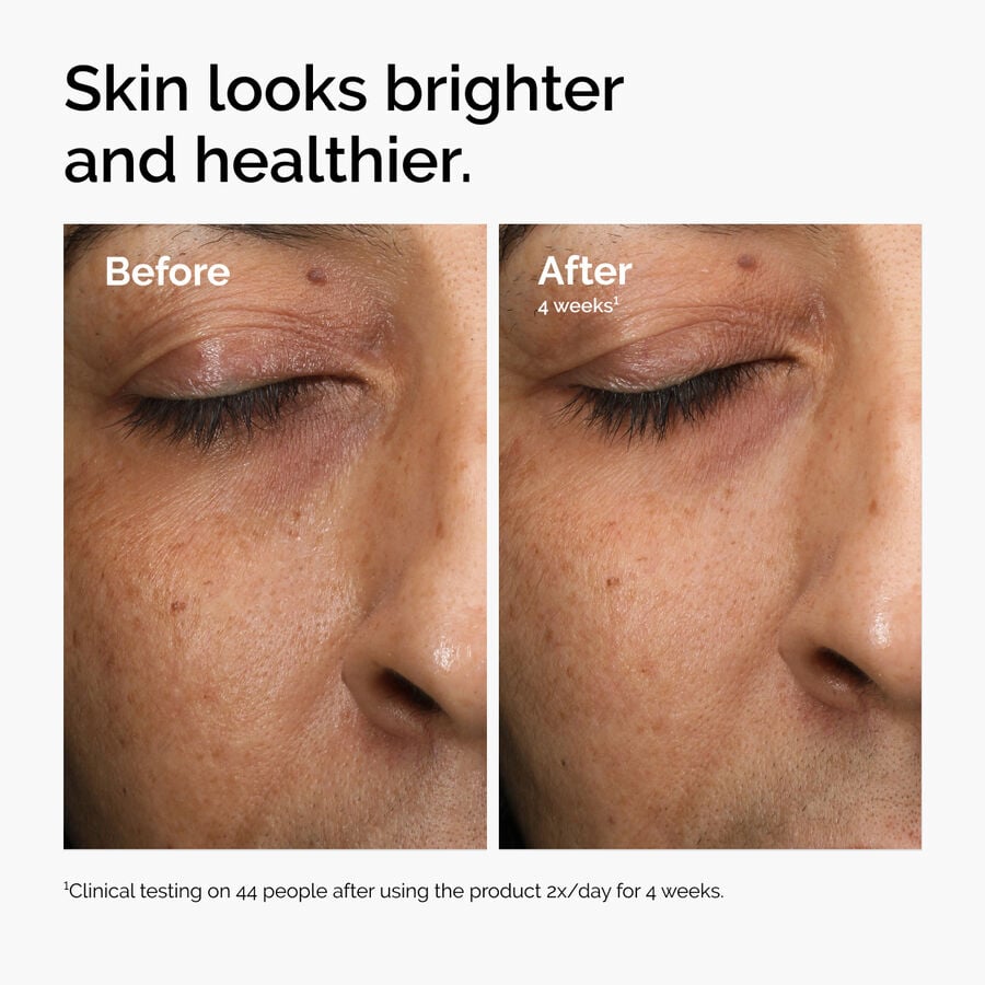 multi-antioxidant-radiance-serum-b7 ord-mars-before-after-healthy.jpg
