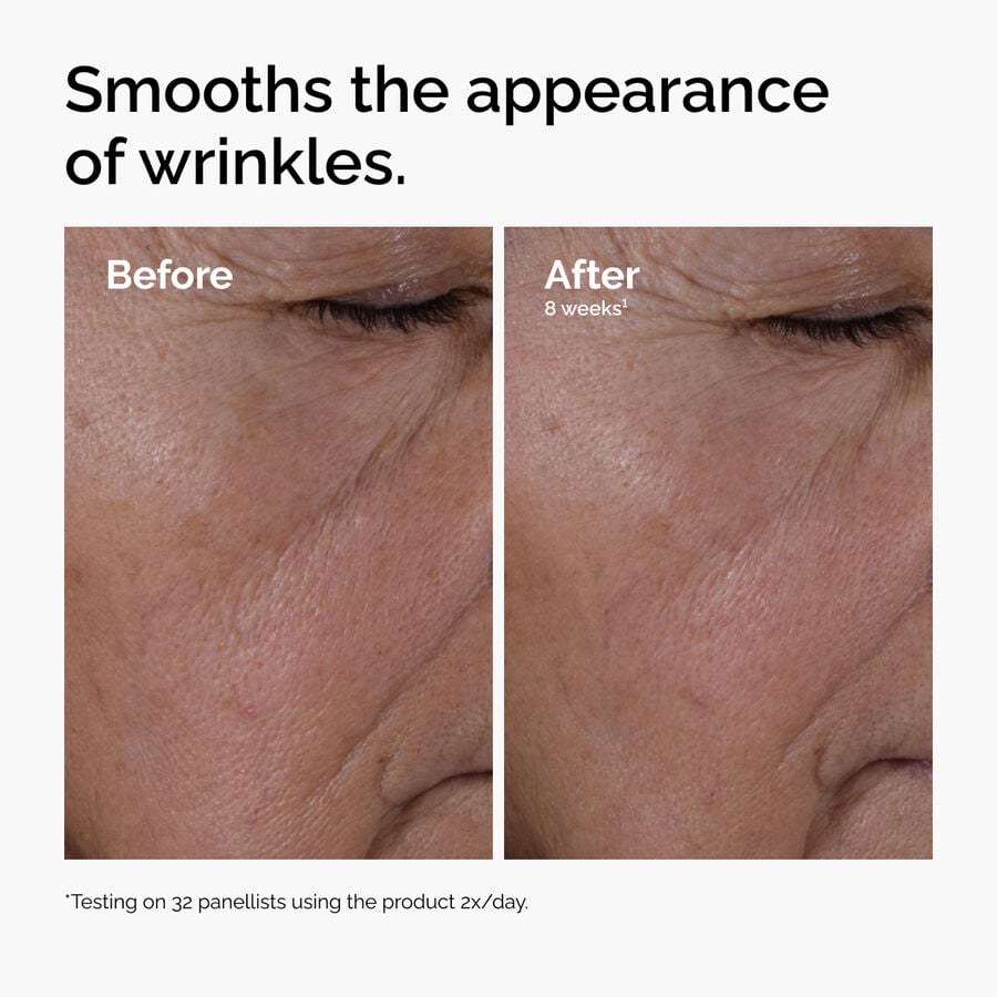 multi-peptide-ha-serum-n5 ord-multi-peptide-ha-serum-wrinkles-before-after.jpg
