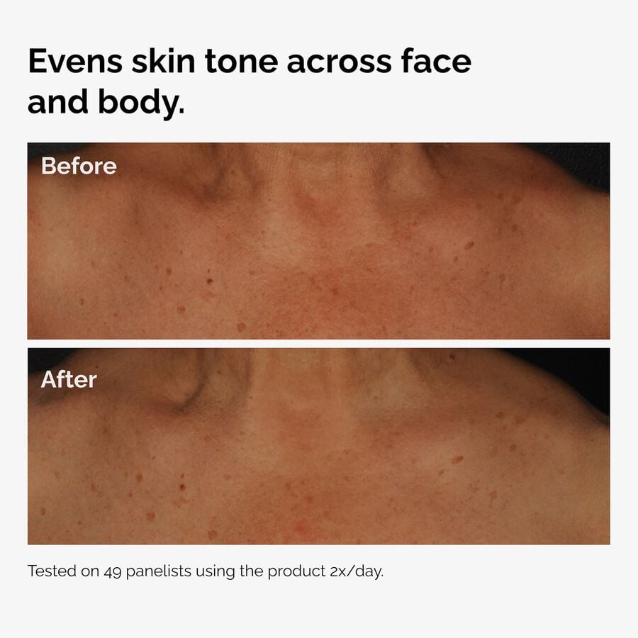the-body-care-collection-m3 ord-niacinamide-face-body-serum-before-after-even-tone-graphic.jpg