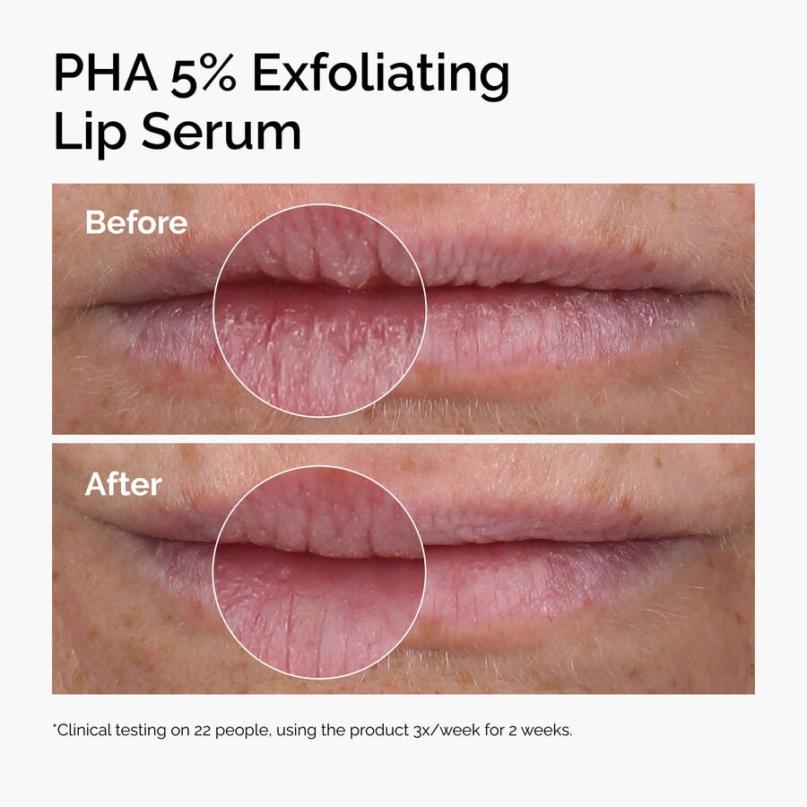 pha-5-exfoliating-lip-serum-z5 ord-pha-5pct-lip-exfoliating-serum-before-after.jpg