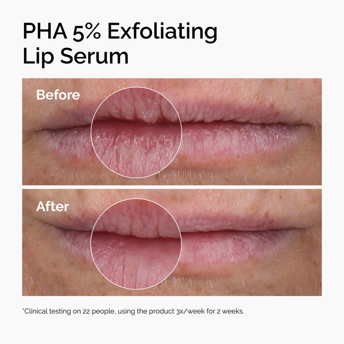 pha-5-exfoliating-lip-serum-z5 ord-pha-5pct-lip-exfoliating-serum-before-after.jpg