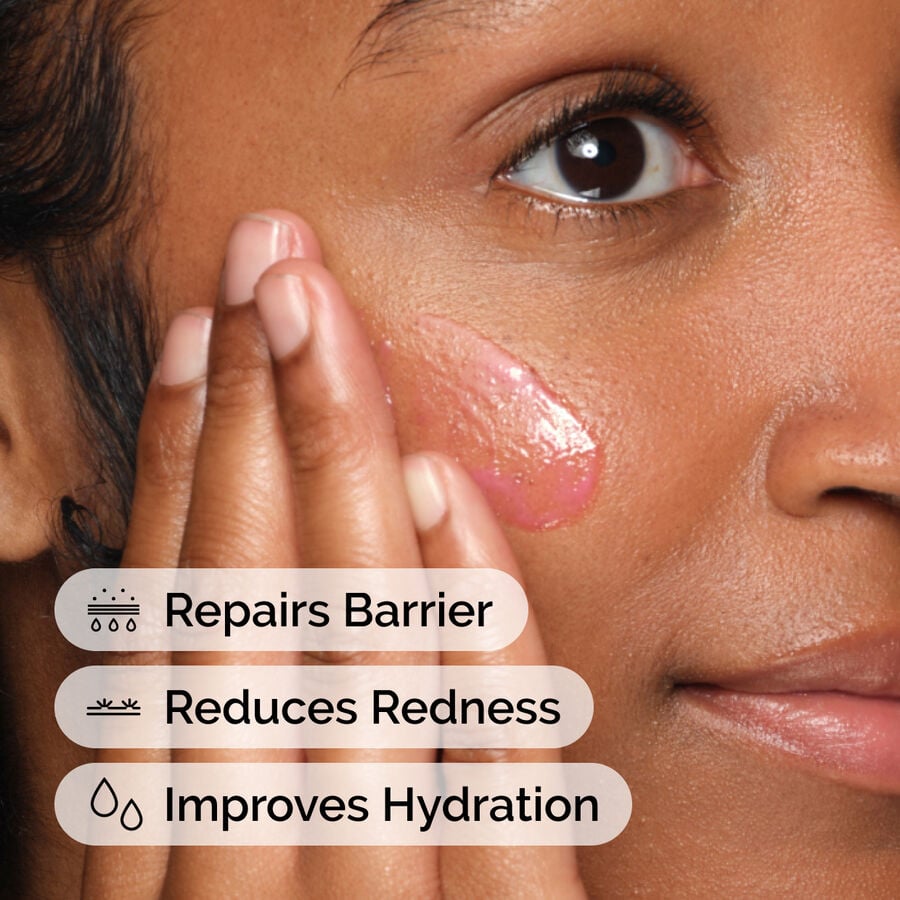 soothing-and-barrier-support-serum-set-y9 ord-soothing-barrier-support-serum-model-application-with-benefits.jpg